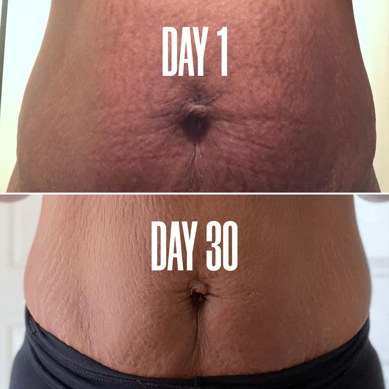 Belly Firming Cream - Skin Tightening and Stretch Mark Remover for Tummy, Thighs, and Arms - Natural and Gentle Body Contouring Lotion for Smooth and Silky Skin