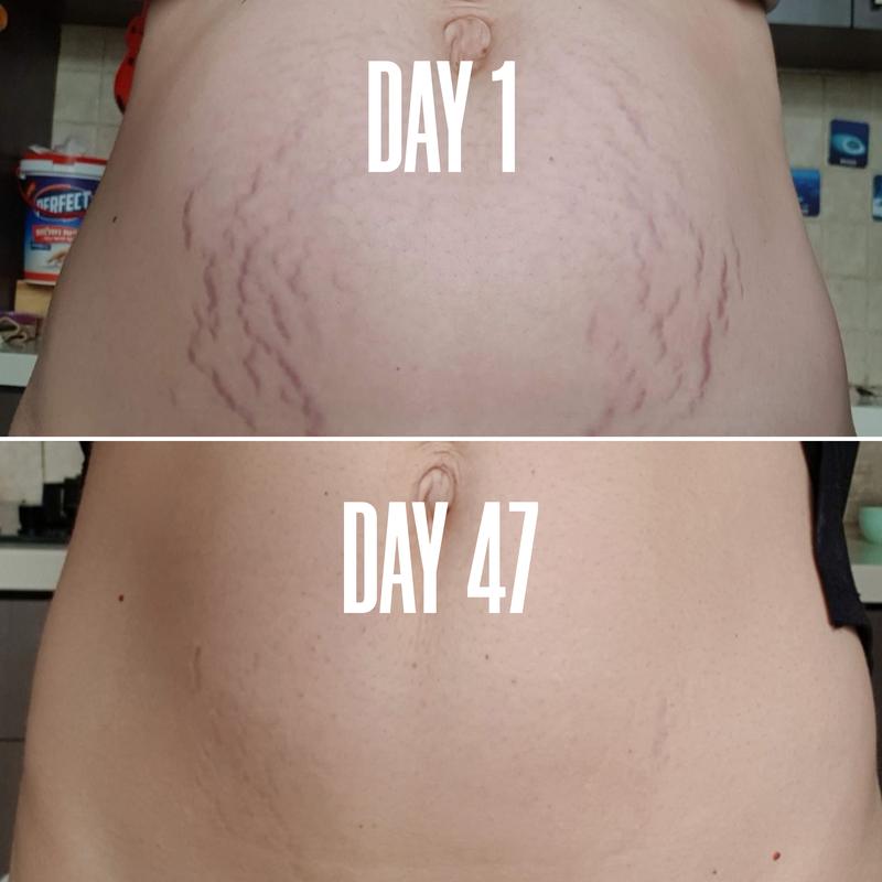 Belly Firming Cream - Skin Tightening and Stretch Mark Remover for Tummy, Thighs, and Arms - Natural and Gentle Body Contouring Lotion for Smooth and Silky Skin