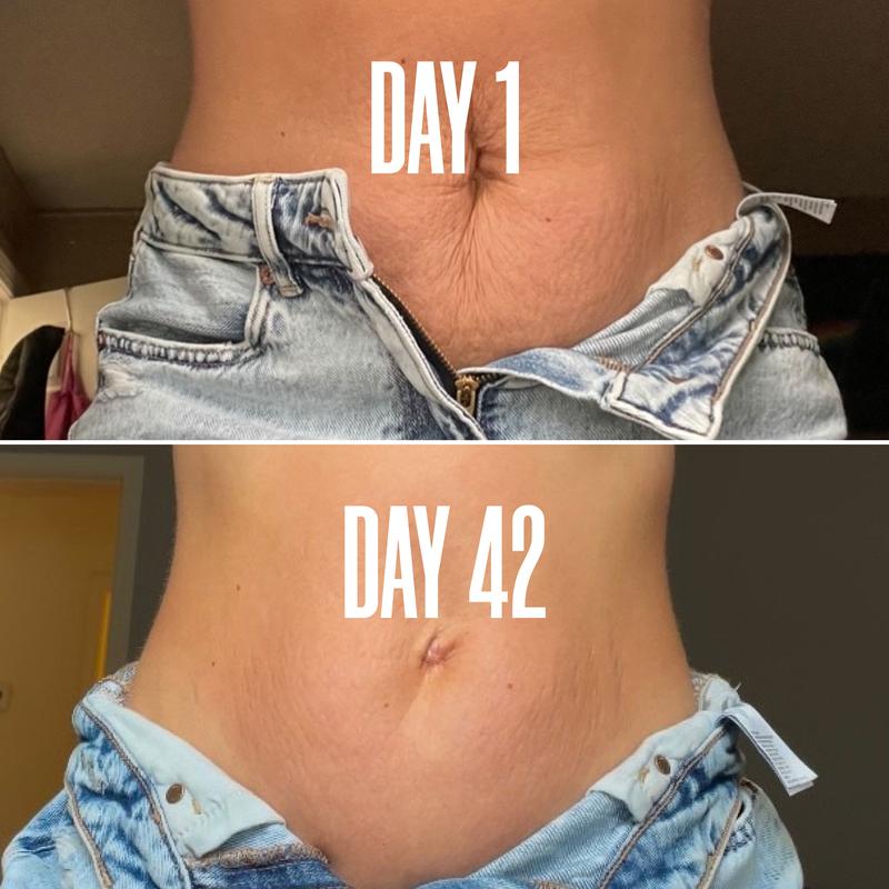 Belly Firming Cream - Skin Tightening and Stretch Mark Remover for Tummy, Thighs, and Arms - Natural and Gentle Body Contouring Lotion for Smooth and Silky Skin